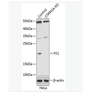Anti-p21 antibody-p21蛋白抗体