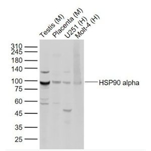 Anti-HSP90 alpha antibody-热休克蛋白90α抗体