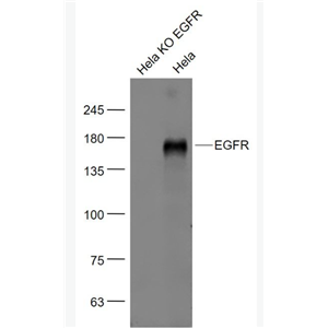 Anti-EGFR antibody-表皮生长因子受体单克隆抗体