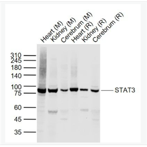 Anti-STAT3 antibody-信号转导和转录激活因子3抗体.