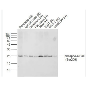 Anti-phospho-eIF4E (Ser209) antibody-磷酸化真核翻译起始因子4E重组兔单抗