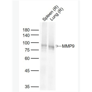 Anti-MMP9 antibody-基质金属蛋白酶-9重组兔单抗