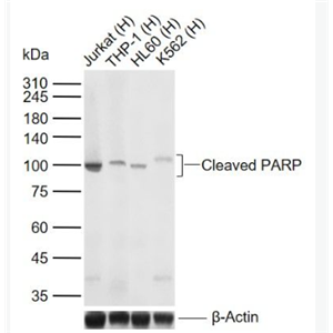 Anti-Cleaved PARP antibody-多腺苷二磷酸多聚酶/多聚ADP-核糖聚合酶1重组兔单抗