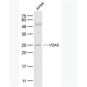 Anti-VDAC (Mitochondrial Loading Control)antibody-等电压依赖性阴离子通道（内参）抗体,VDAC (Mitochondrial Loading Control)