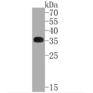 Anti-HLA-DR antibody-HLA-DR重组兔单抗