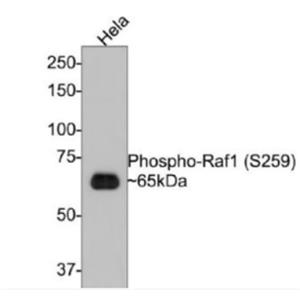 Anti-phospho-RAF1 (Ser259) antibody-磷酸化原癌基因RAF1重组兔单抗