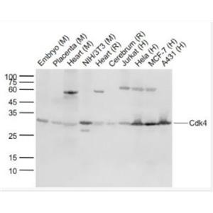 Anti-Cdk4 antibody-周期素依赖性激酶4单克隆抗体