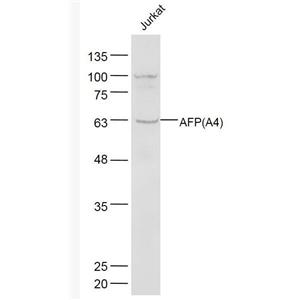 Anti-AFP(A4)   antibody-甲胎蛋白单克隆抗体(检测)