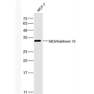 Anti-NES/Kallikrein 10  antibody-上皮细胞特异性蛋白1抗体