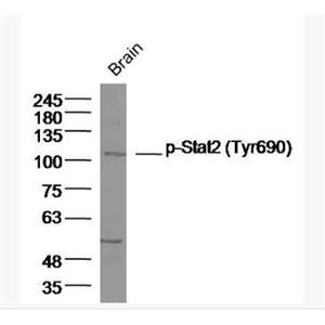 Anti-Phospho-Stat2 (Tyr690) antibody-磷酸化信号转导和转录激活因子2抗体