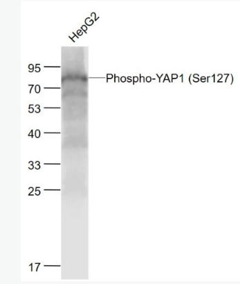 Anti-Phospho-YAP1 (Ser127) antibody-磷酸化原癌基因Yes相关蛋白1重组兔单抗,Phospho-YAP1 (Ser127)