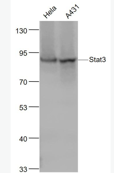 Anti-STAT3 antibody-信号转导和转录激活因子3重组兔单抗,STAT3