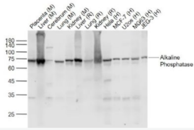 Anti-Alkaline phosphatase, tissue-nonspecific isozyme antibody-碱性磷酸酶重组兔单抗,Alkaline phosphatase, tissue-nonspecific isozyme