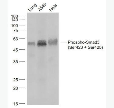 Anti-Phospho-Smad3 (Ser423 + Ser425) antibody-磷酸化细胞信号转导分子SMAD3重组兔单抗,Phospho-Smad3 (Ser423 + Ser425)