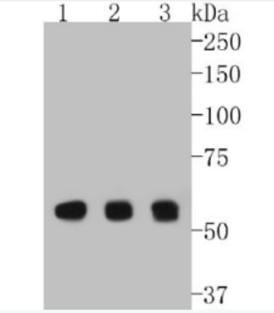 Anti-Cyclin B1 antibody-周期素B1重組兔單抗,Cyclin B1