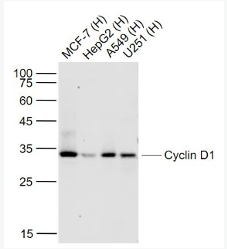 Anti-Cyclin D1 antibody-周期素D1重组兔单抗,Cyclin D1
