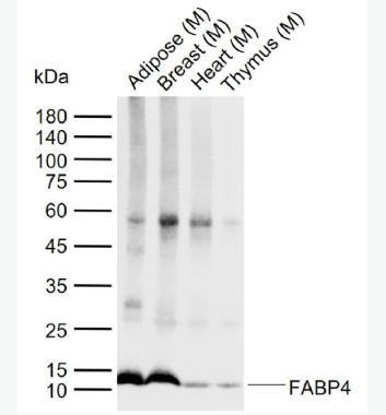 Anti-FABP4  antibody-脂肪细胞型脂肪酸结合蛋白单克隆抗体,FABP4