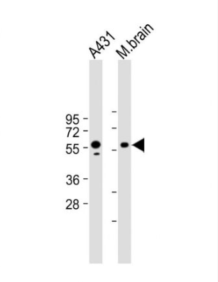 Anti-PINK1  antibody-丝氨酸/苏氨酸蛋白激酶PINK1单克隆抗体,PINK1