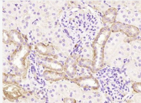 Anti-phospho-IRF3 (Ser386) antibody-磷酸化干扰素调节因子3重组兔单抗,phospho-IRF3 (Ser386)