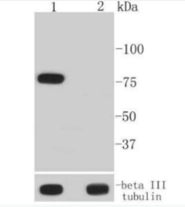 Anti-Phospho-BTK (Tyr223) antibody-磷酸化酪氨酸蛋白激酶BTK重组兔单抗,Phospho-BTK (Tyr223)