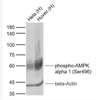 Anti-phospho-AMPK alpha 1 (Ser496) antibody-磷酸化腺苷單磷酸活化蛋白激酶α1重組兔單抗,phospho-AMPK alpha 1 (Ser496)