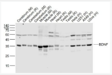 Anti-BDNF antibody-脑源神经营养因子重组兔单抗,BDNF