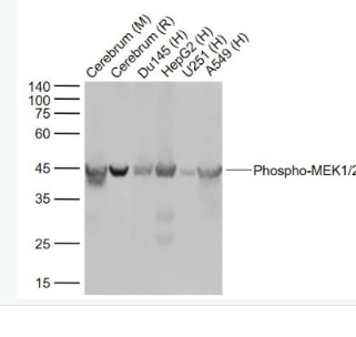 Anti-Phospho-MEK1/2 (Ser218 + Ser222)antibody-磷酸化丝裂原活化蛋白激酶激酶1/2重组兔单抗,Phospho-MEK1/2 (Ser218 + Ser222)