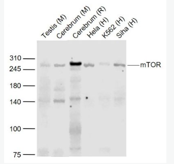 Anti-mTOR  antibody-雷帕霉素靶蛋白重组兔单抗,mTOR