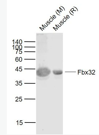 Anti-Fbx32 antibody-泛素蛋白连接酶重组兔单抗,Fbx32