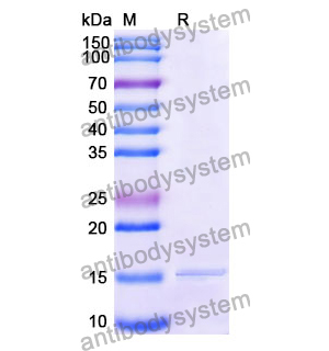 抗 Human CD66c/CEACAM6 纳米抗体 (SAA1208)(RHE25601),Anti-Human CD66c/CEACAM6 Nanobody (SAA1208)