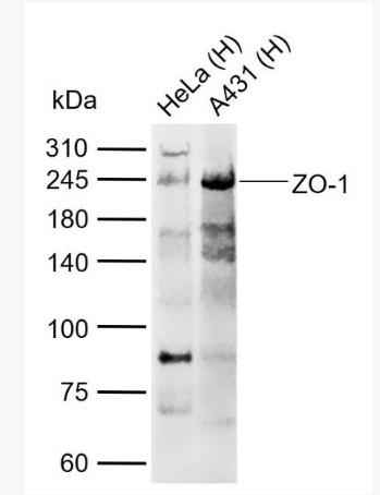 Anti-ZO-1 antibody-胞质紧密粘连蛋白1/闭锁小带蛋白1抗体,ZO-1