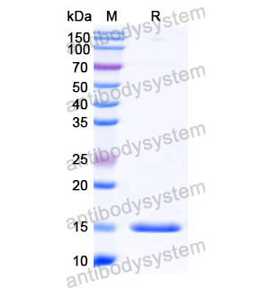 抗 Human MET/c-Met/HGFR 纳米抗体 (SAA1308)(RHC34202),Anti-Human MET/c-Met/HGFR Nanobody (SAA1308)