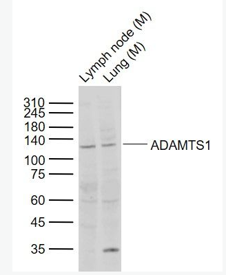 Anti-ADAMTS1  antibody-整合素样金属蛋白酶与凝血酶1型抗体,ADAMTS1