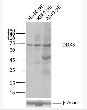 Anti-DDX3 antibody-三磷酸腺苷依赖解旋酶DDX3抗体,DDX3