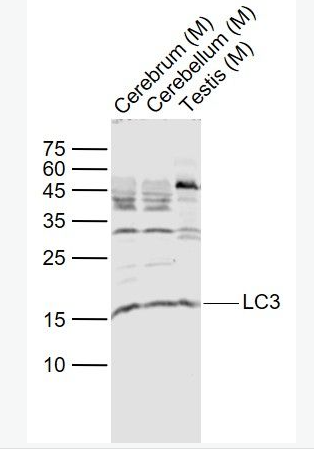 Anti-LC3 antibody-自噬微管相關(guān)蛋白輕鏈3抗體,LC3