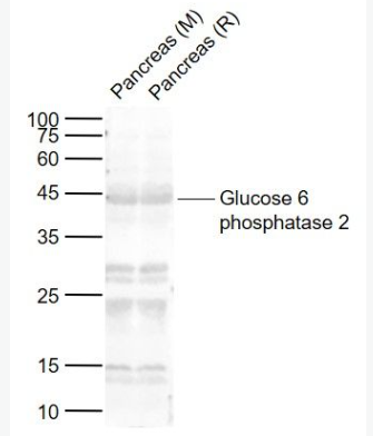 Anti-Glucose 6 phosphatase 2 antibody-胰岛葡萄糖6磷酸酶2抗体,Glucose 6 phosphatase 2