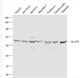 Anti-GLUT3 antibody-葡萄糖转运蛋白3抗体,GLUT3