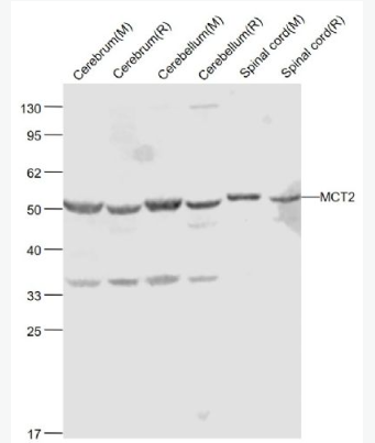 Anti-MCT2 antibody-单羧酸转运蛋白2抗体,MCT2