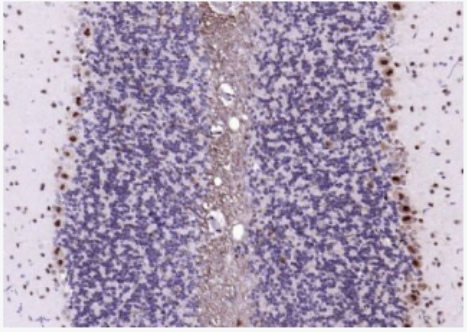 Anti-ITGB2 antibody-整合素β2（CD18）抗体,ITGB2