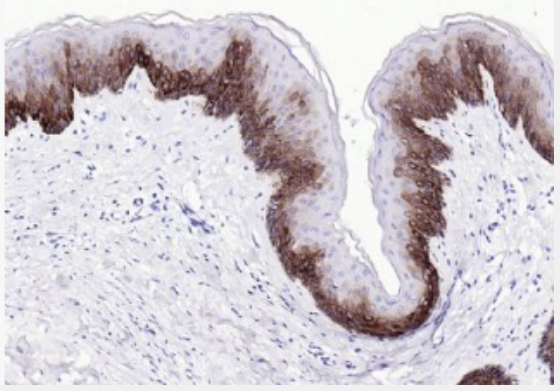 Anti-MUC1 antibody-粘蛋白-1抗体,MUC1