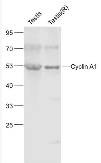 Anti-Cyclin A1 antibody-周期素A1蛋白抗体,Cyclin A1