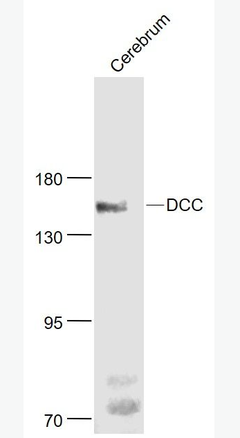 Anti-DCC antibody-结肠直肠癌缺失基因抗体,DCC