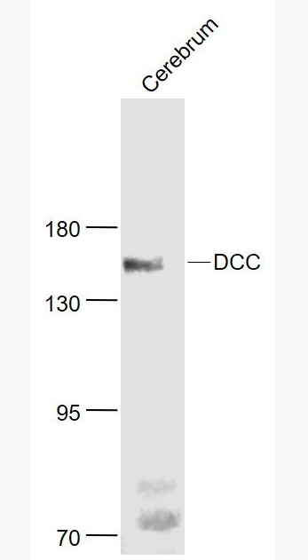 Anti-DCC antibody-結(jié)腸直腸癌缺失基因抗體,DCC