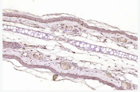 Anti-Axin1 antibody-轴蛋白1抗体,Axin1