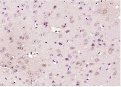 Anti-SRD5A1 antibody-類固醇5α還原酶1抗體(5α-Reductase 1),SRD5A1