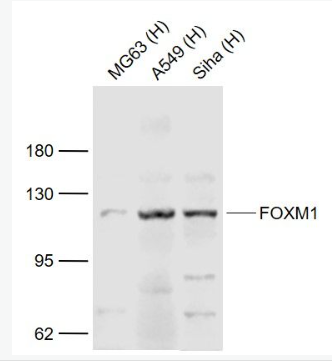 Anti-FOXM1 antibody-叉頭蛋白M1抗體,FOXM1