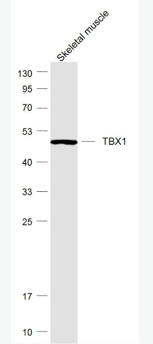 Anti-TBX1 antibody-先心病相關(guān)蛋白TBX1抗體,TBX1