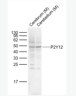 Anti-P2Y12  antibody-G蛋白偶联嘌呤受体p2y12抗体,P2Y12