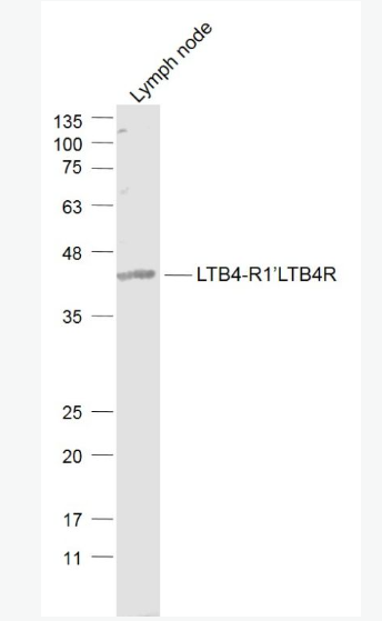 Anti-LTB4-R1/LTB4R antibody-白三烯B4受体1抗体,LTB4-R1/LTB4R