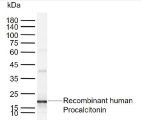Anti-Procalcitonin (PCT)antibody-降钙素原单克隆抗体,Procalcitonin (PCT)